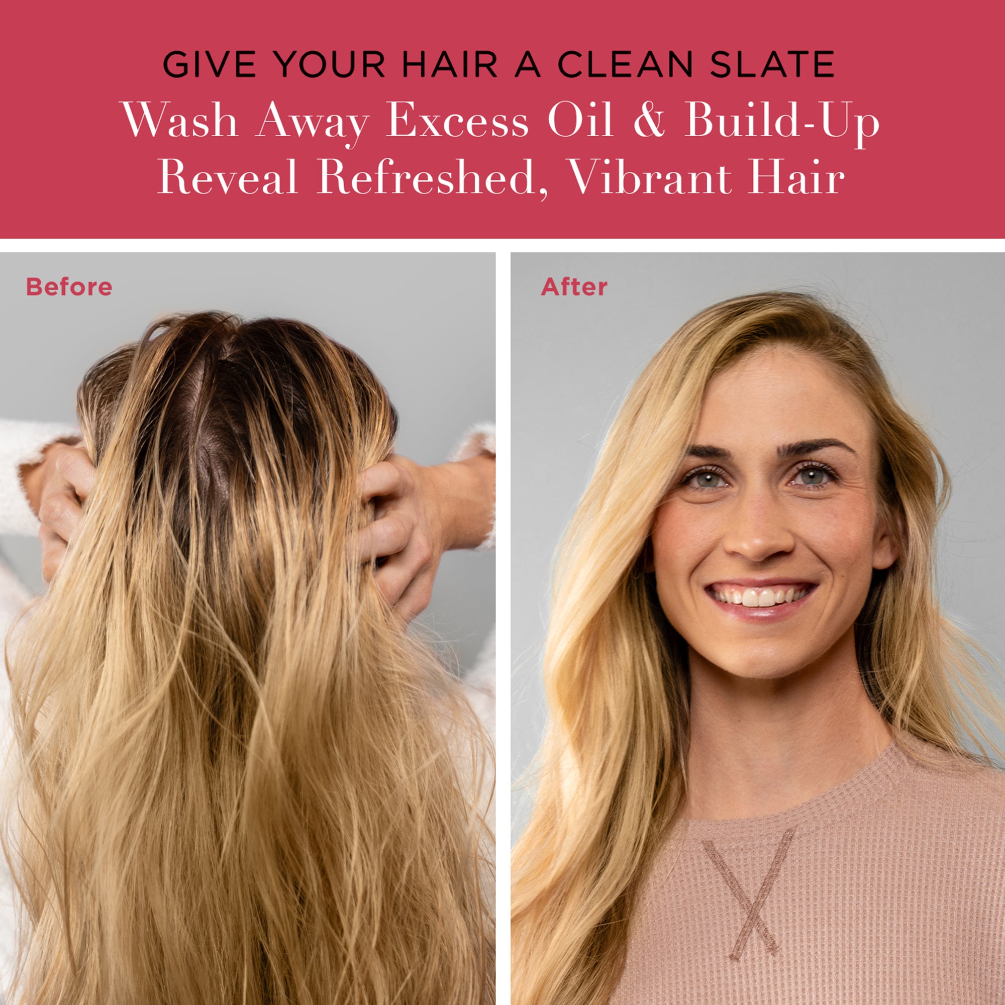 The Total Hair Solution